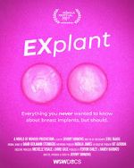 Watch Explant Vumoo
