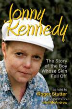 Watch The Boy Whose Skin Fell Off Vumoo