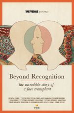 Watch Beyond Recognition: The Incredible Story of a Face Transplant Vumoo